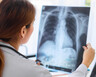 A doctor looks at a X-ray scan of a patient's lungs.