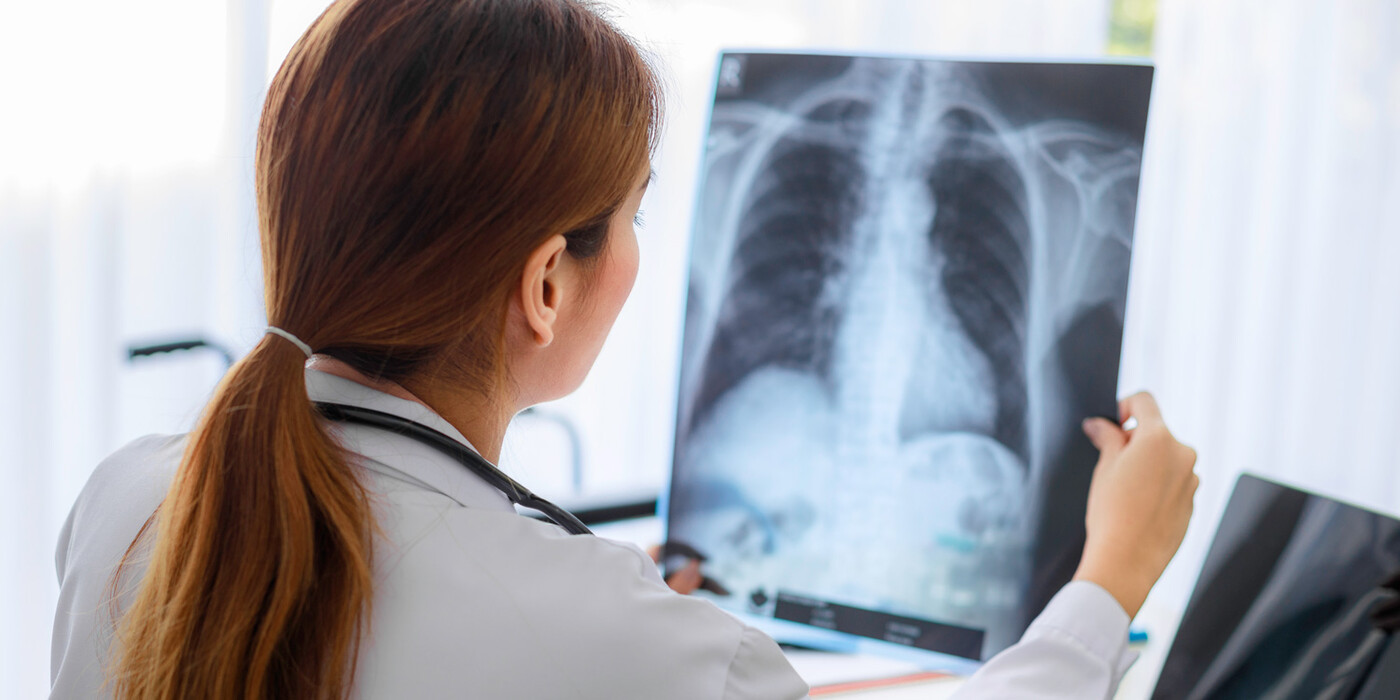 A doctor looks at a X-ray scan of a patient's lungs.
