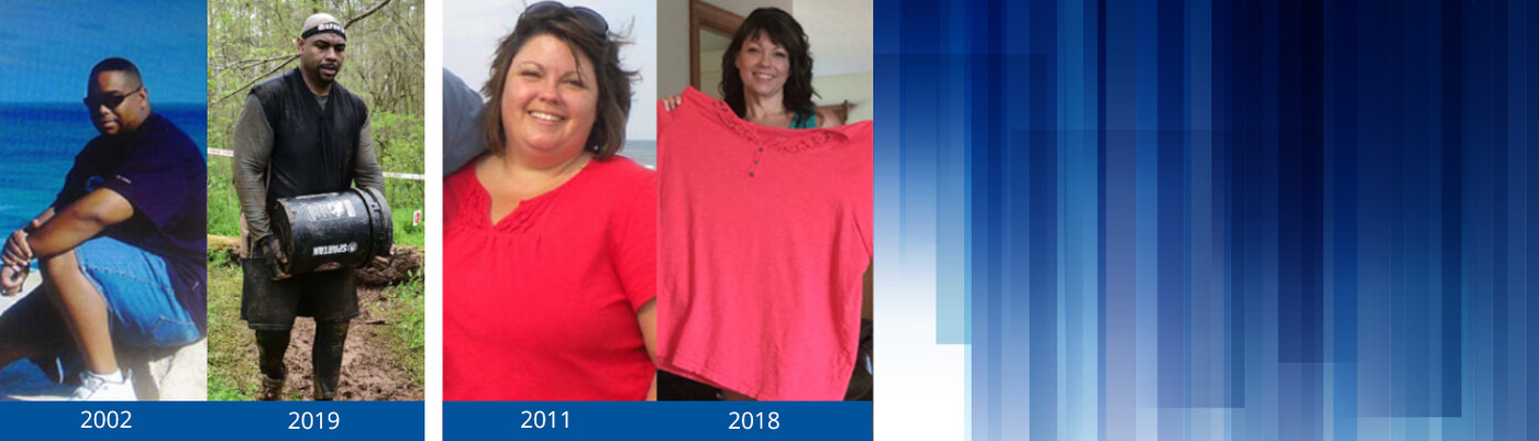 Weight Loss Surgery Before and After Photos